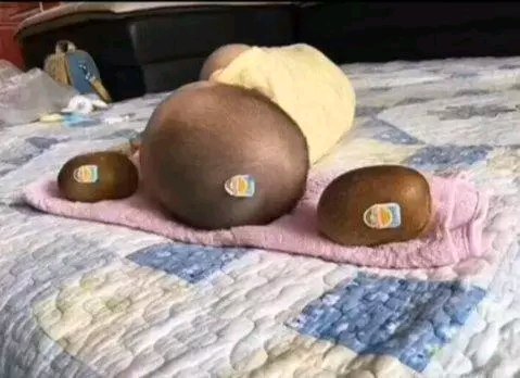 一个小孩头顶和两个猕猴桃的图片